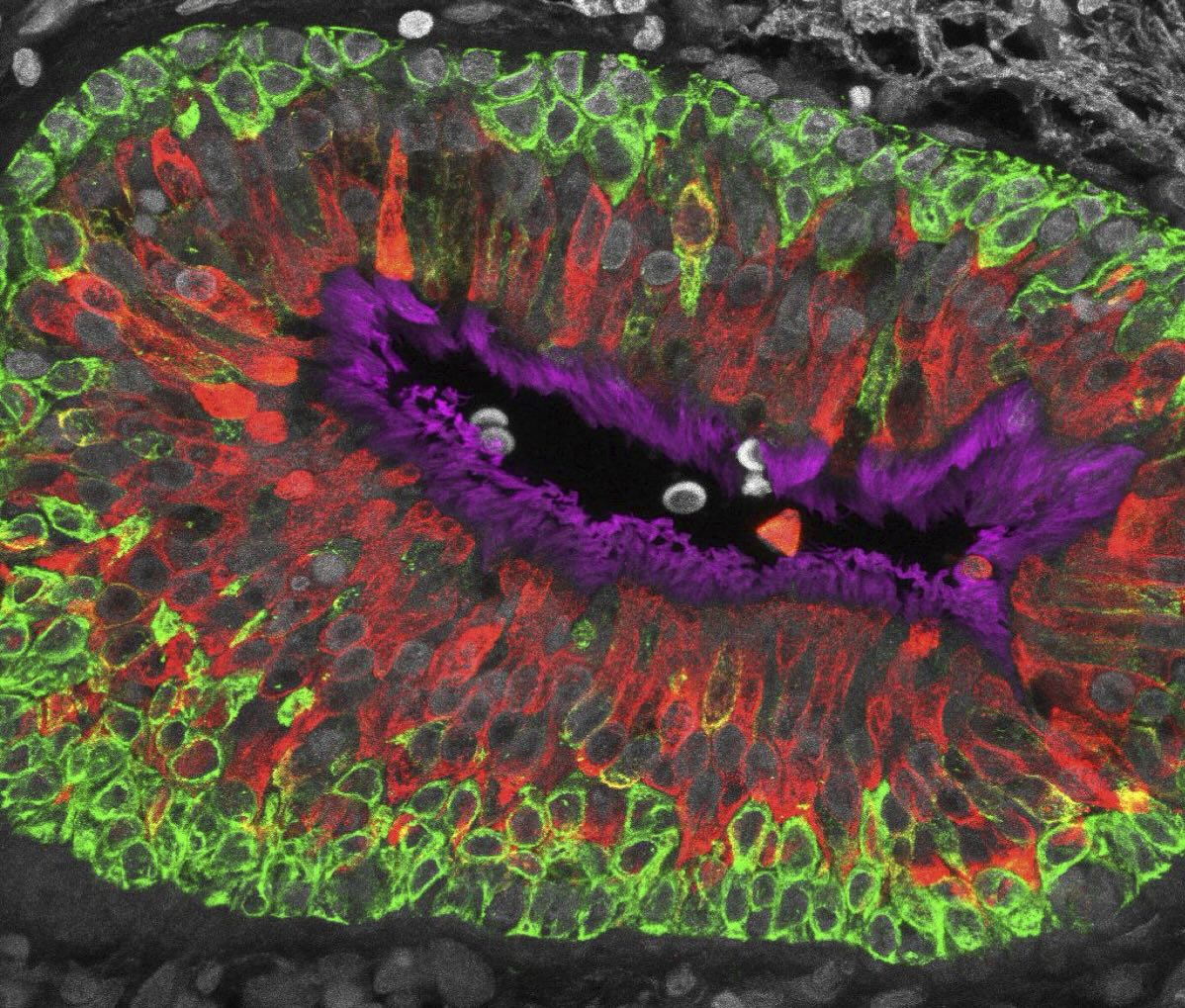Immunofluorescence staining of human airway epithelium