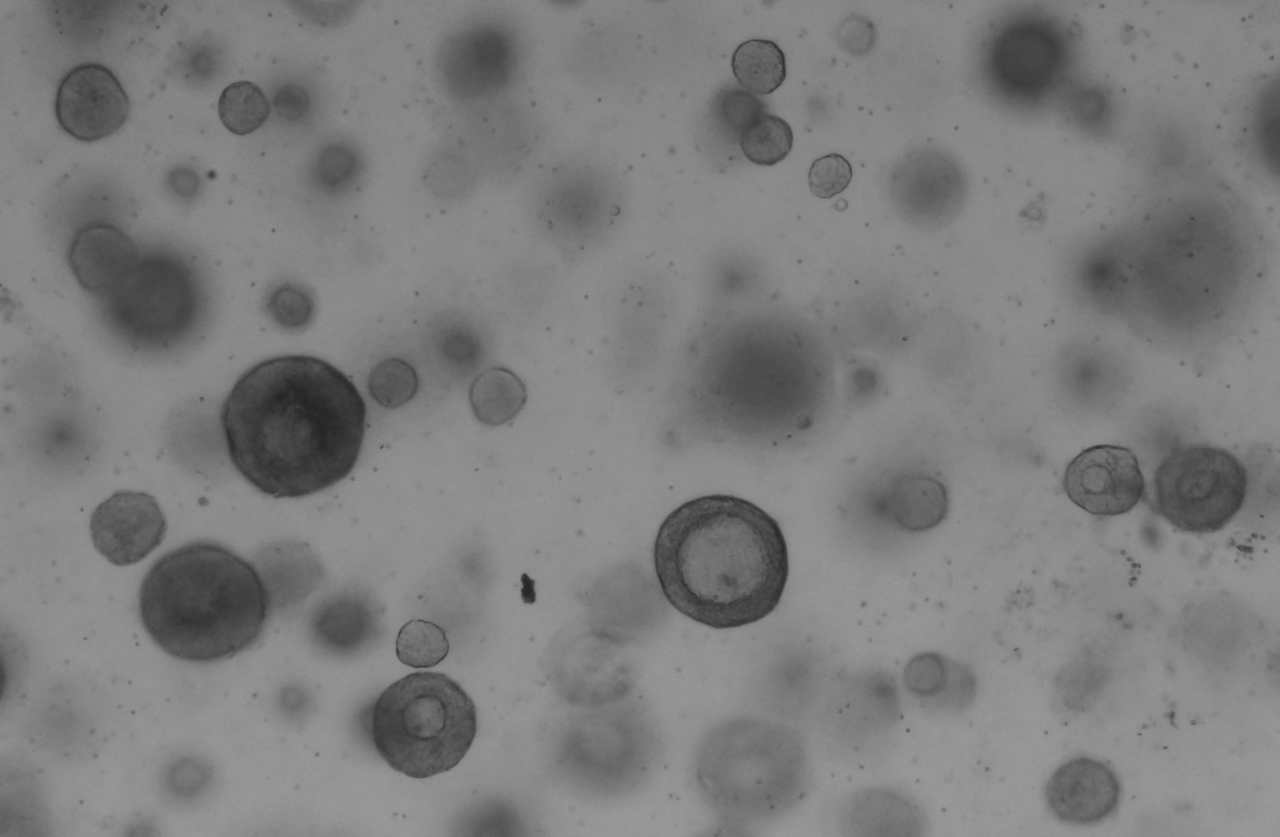 Airway epithelial organoids